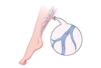 Illustration d'une jambe avec le schéma de la circulation sanguine